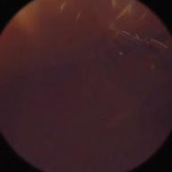 🥞ちーこ🍒-この場所で出会えたから《レコおと》-Airi