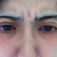 いとうさん-火炎-女王蜂